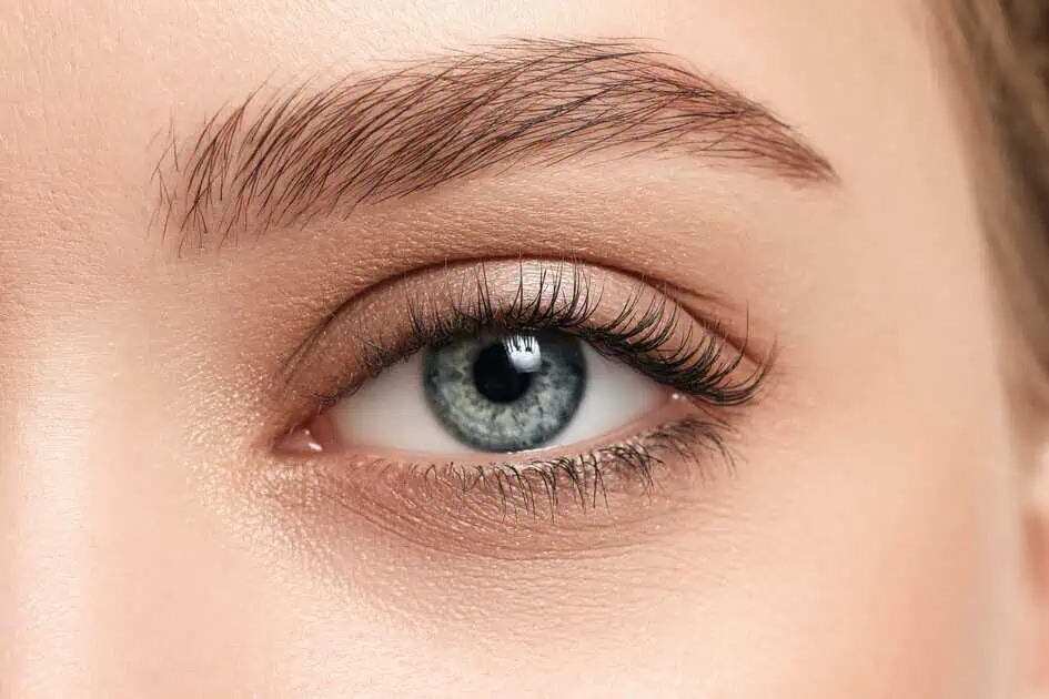 Under Eye Smooth Threads in Cary, NC by Medical Aesthetics NC PLLC