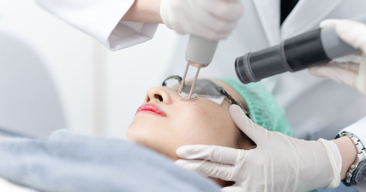 Woman receiving Cynosure-Lutronic Clarity II Laser Treatments in Cary, NC with Protective Eyewear